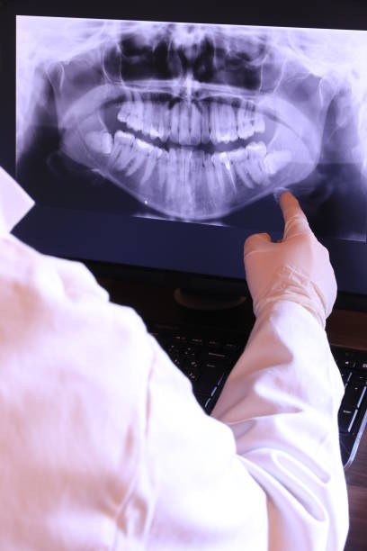 Best Emergency Wisdom Teeth Removal in West Branch, MI
